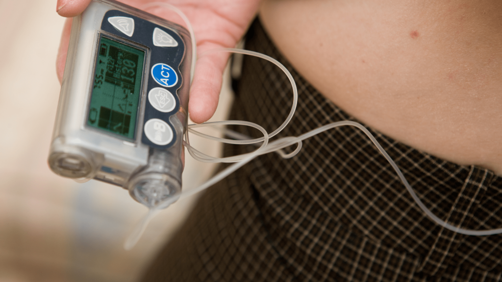 connected insulin pump