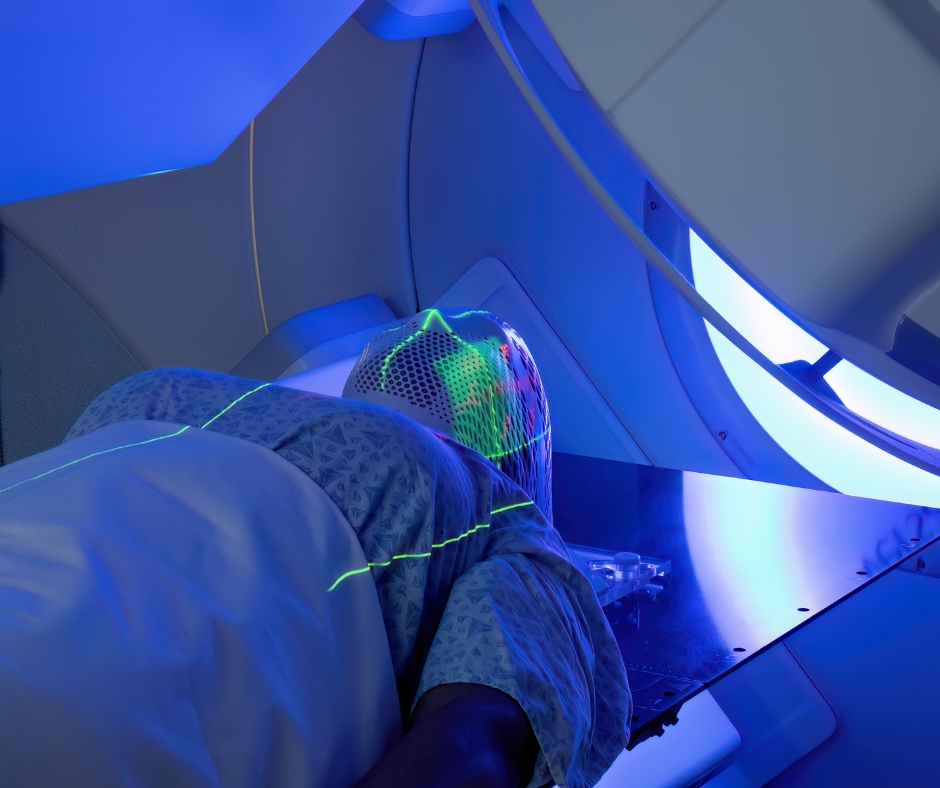 Caption: External beam radiotherapy for thyroid cancer is not a primary treatment and is used in specific situations, primarily for anaplastic or medullary thyroid cancer.